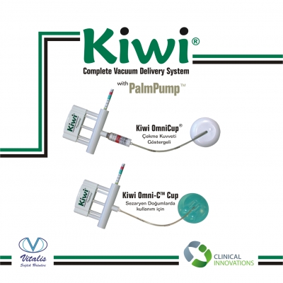Kiwi